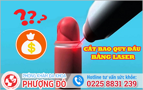 Cắt bao quy đầu bằng Laser bao nhiêu tiền?