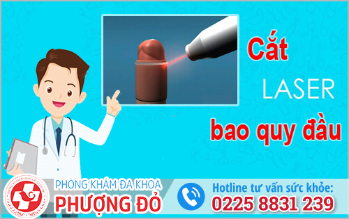 Cắt bao quy đầu bằng Laser 