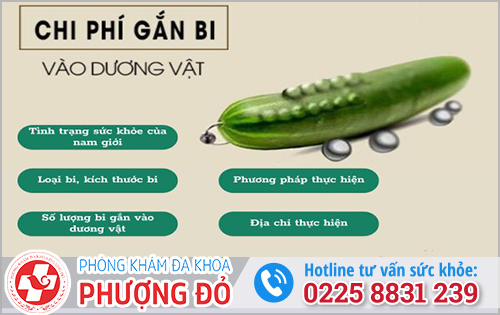 Chi phí gắn bi vào dương vật