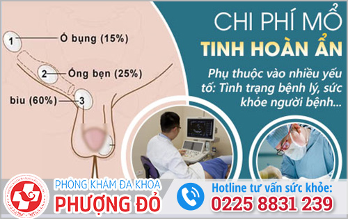 Chi phí mổ tinh hoàn ẩn