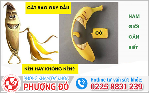 Có nên cắt bao quy đầu không?