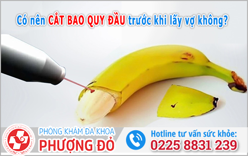 Có nên cắt bao quy đầu trước khi lấy vợ không?