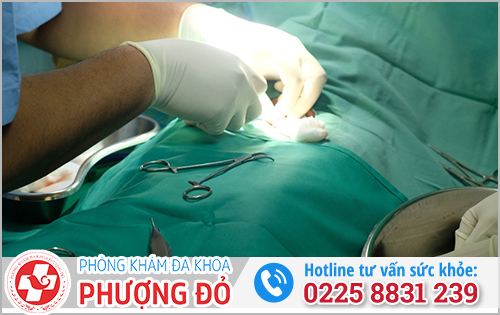 Phòng khám cắt bao quy đầu uy tín tại Hải Phòng