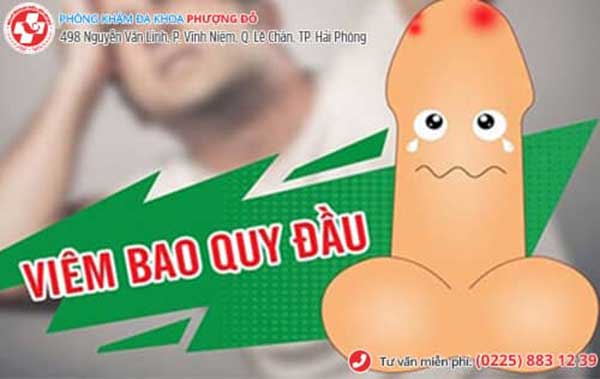 dài bao quy đầu