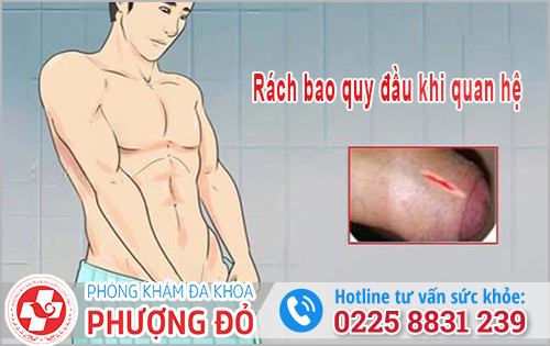 Bao quy đầu dài có quan hệ được không?