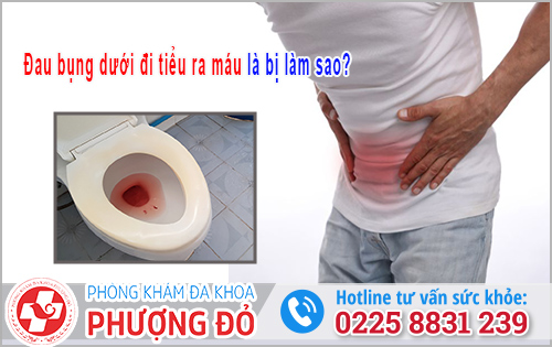 Đau bụng dưới đi tiểu ra máu