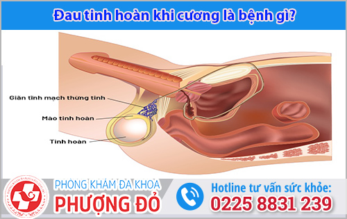 Đau tinh hoàn khi cương