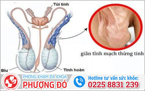 Mối nguy hại khi bị đau tinh hoàn