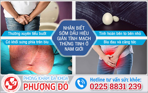 Đau tức tinh hoàn nhưng không sưng do bệnh giãn mạch thừng tinh