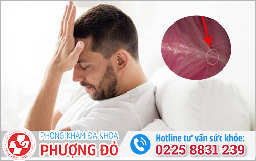 Sưng dây hãm bao quy đầu có sao không?