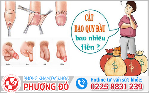 Chi phí cắt bao quy đầu ngoài giờ tại Hải Phòng