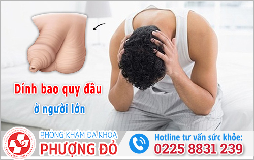Dính bao quy đầu ở người lớn