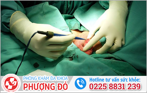 Điều trị dính bao quy đầu