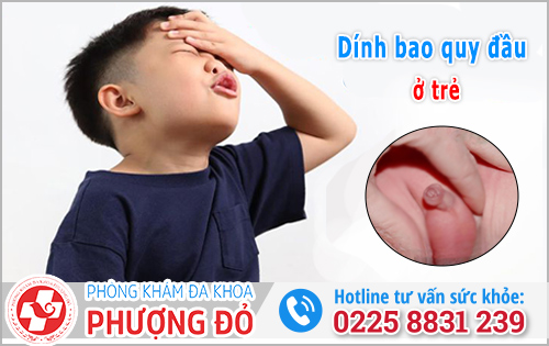 Dính bao quy đầu ở trẻ em