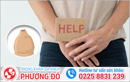 Dính bao quy đầu là gì?