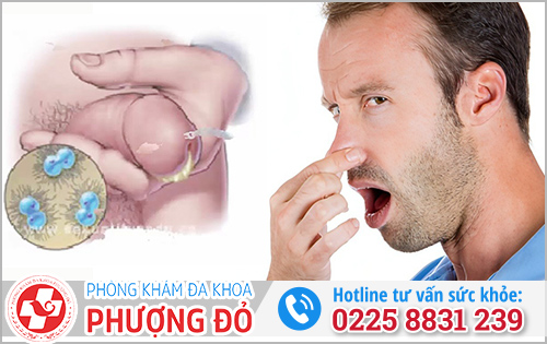 Dương vật có mùi hôi có sao không?