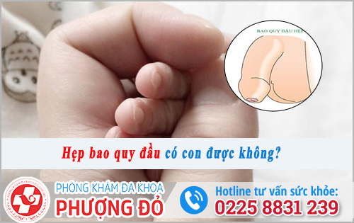 Hẹp bao quy đầu có con được không?