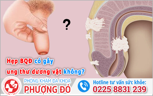 Hẹp bao quy đầu có gây ung thư dương vật không?