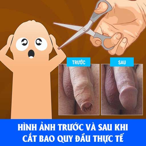 Hình ảnh trước và sau khi cắt bao quy đầu thực tế