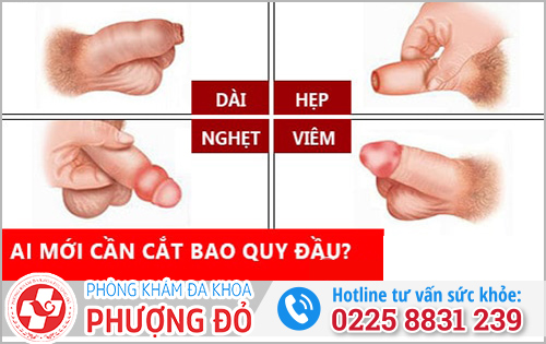 Khi nào mới cần cắt bao quy đầu?