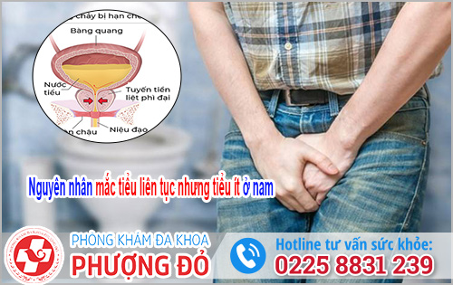 Mắc tiểu liên tục nhưng tiểu ít ở nam 