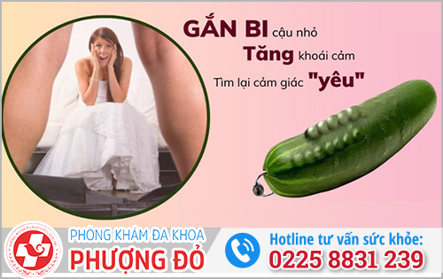 Phương pháp gắn bi dương vật như thế nào?