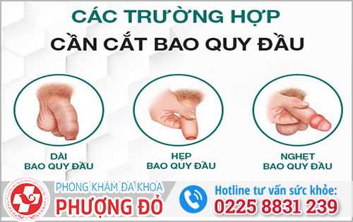 Trường hợp nào nam 40 tuổi cần cắt bao quy đầu?