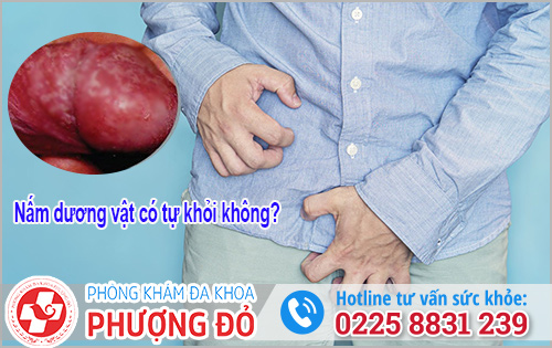 Nấm dương vật có tự khỏi không?