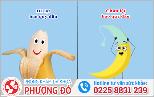 Dấu hiệu trẻ 12 tuổi chưa lột bao quy đầu