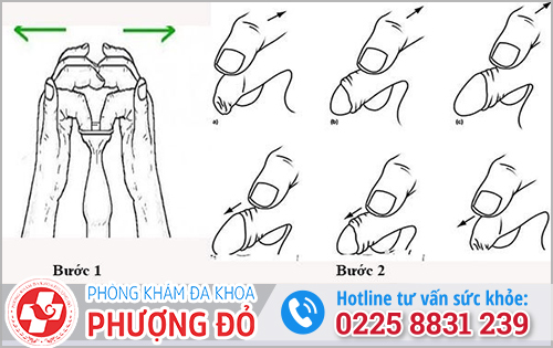 Cách lột bao quy đầu cho trẻ 12 tuổi