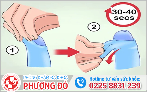 Cách lột bao quy đầu cho trẻ 14 tuổi