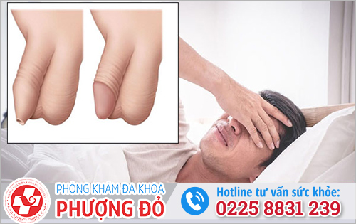 Tác hại 15 tuổi chưa lột bao quy đầu