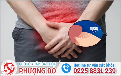 Dây chằng bao quy đầu bị ngắn 