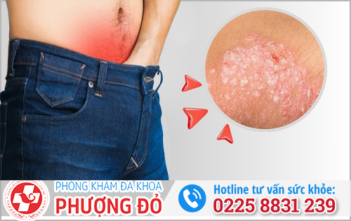 Nguyên nhân ngứa bìu vào ban đêm