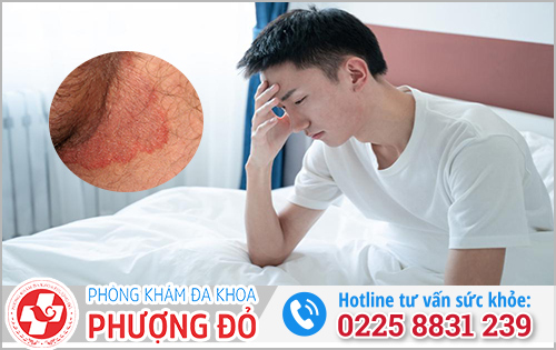 Ngứa da bìu vào ban đêm có nguy hiểm không?