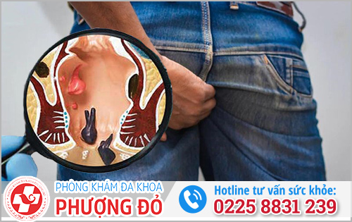 Ngứa hậu môn buổi sáng là bệnh gì?