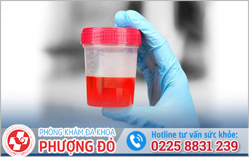 Đi tiểu ra máu có nguy hiểm không?