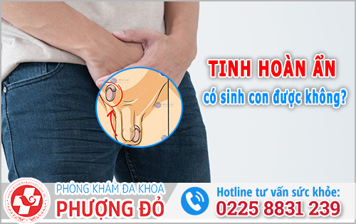 Tinh hoàn ẩn có sinh con được không?