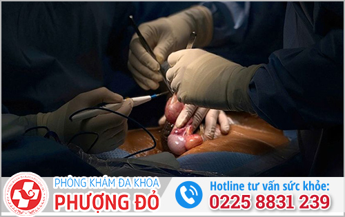 Điều trị tinh hoàn ẩn