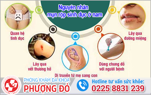 Nguyên nhân bị mụn rộp sinh dục ở nam