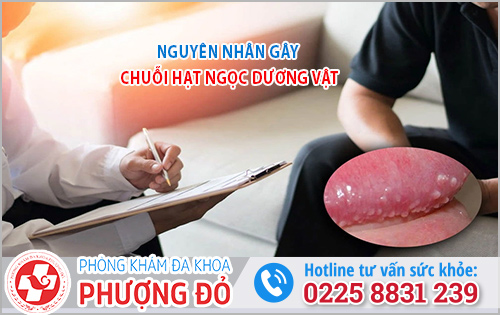 Nguyên nhân gây chuỗi hạt ngọc dương vật 