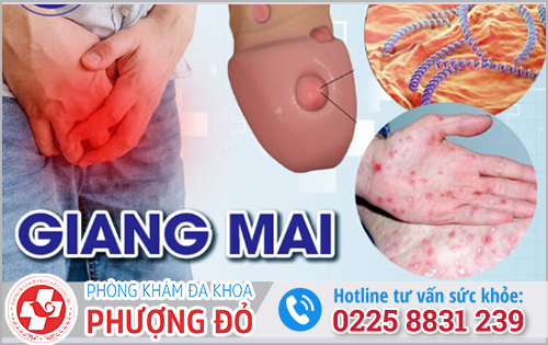 Dương vật nổi đốm trắng