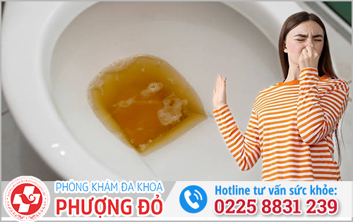 Nước tiểu có mùi thối là dấu hiệu bệnh gì?