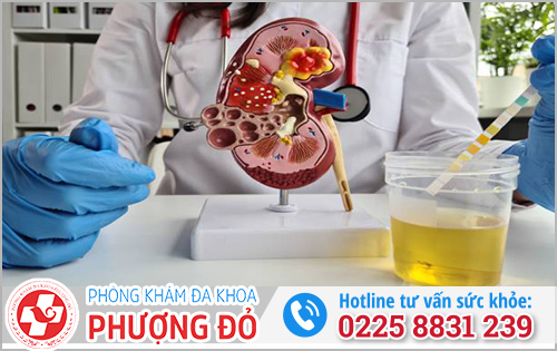 Bác sĩ đang phân tích điều trị nước tiểu có mùi khai nặng 