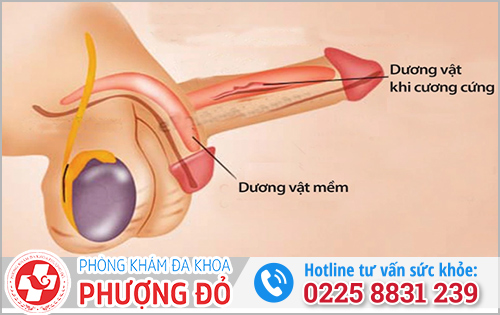 Tình trạng bình thường của dương vật