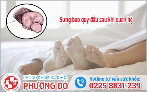 Sưng bao quy đầu sau khi quan hệ