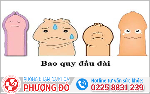 Quan hệ xong bị sưng bao quy đầu