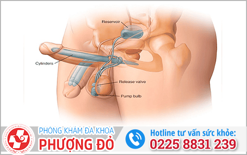 Dấu hiệu nhận biết rối loạn cương dương