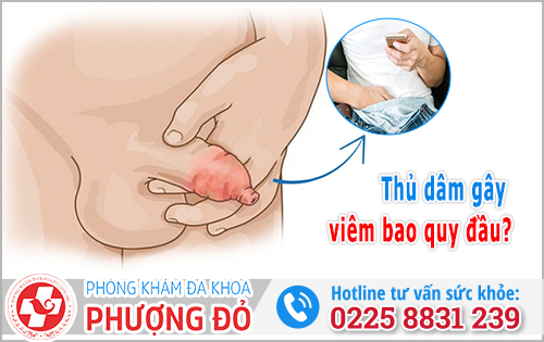 Thủ dâm gây viêm bao quy đầu 