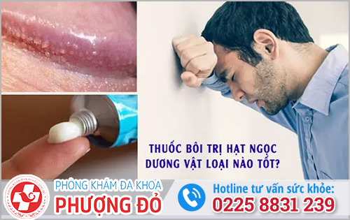 Thuốc bôi chữa chuỗi hạt ngọc dương vật